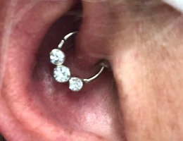 Daith Piercing for Migraine Harley Street London