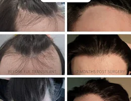 Harley Street Hair Transplant Clinic