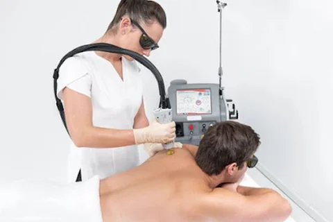 Photo Laser Hair Removal Walsall | Bayside Aesthetics