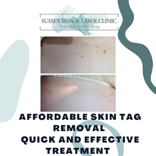 Photo Sussex Skin and Laser Clinic