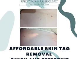 Sussex Skin and Laser Clinic