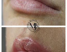 Melanie Jayne's Beauty & Aesthetics Clinic - MJ's