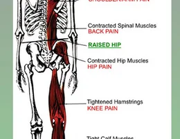 Keepfit (Acupuncture, Cupping, massage,chiropractor)