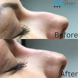 Photo ND Skin Aesthetics - Leicester