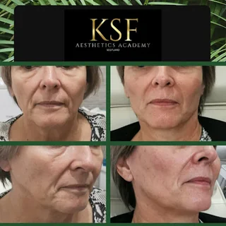 Photo KSF Aesthetics & Academy