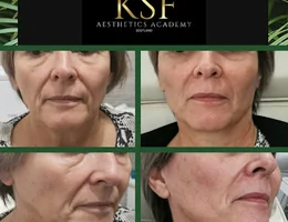 KSF Aesthetics & Academy