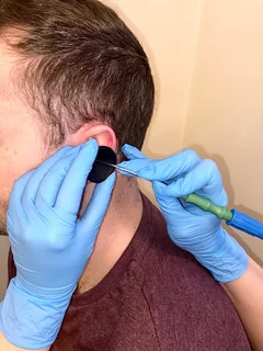 Photo Newcastle Ear Care - Ear Wax Removal