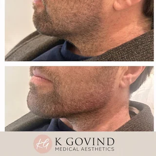 Photo K Govind, Medical Aesthetics