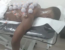 Cupping Hijama in London, E12, London