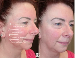 Skin Restore