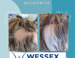 Wessex Trichology Clinic Ltd