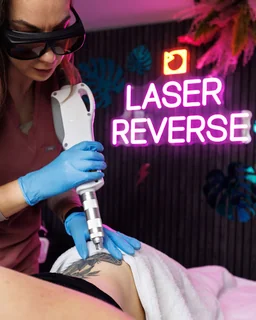 Photo Laser Reverse