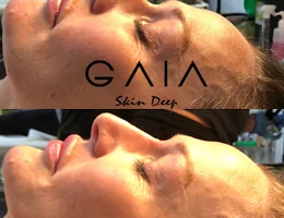 Gaia Skin Deep