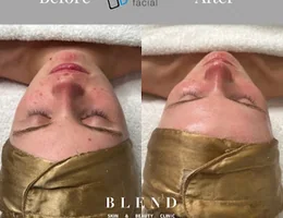 Blend Skin and Medical Aesthetics