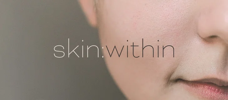 Photo skin:within