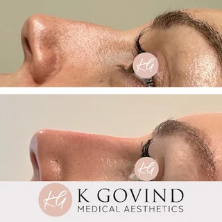 Photo K Govind, Medical Aesthetics