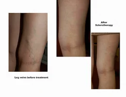 Coltishall Clinic Laser Skin and Vein Care