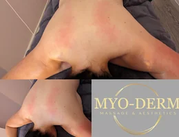 Myo-Derm Massage and Aesthetics