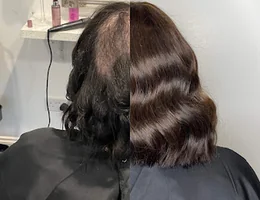 Solution Hair Replacement