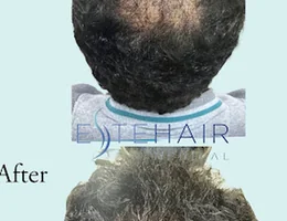 EsteHair Medical - skin & hair loss clinic