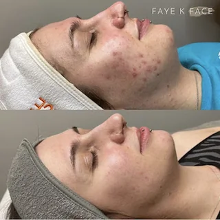 Photo Faye K Face Skin Clinic