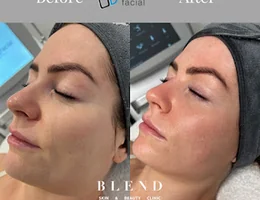 Blend Skin and Medical Aesthetics