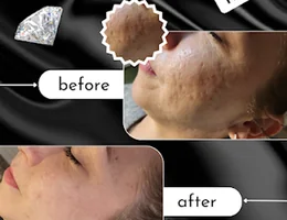 Perfect Piercings, Skin & Laser Clinic