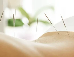 YOLO Acupuncture