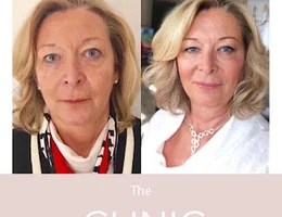 The Clinic Cheshire