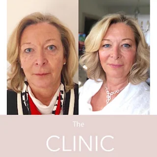 Photo The Clinic Cheshire