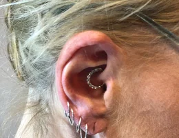 Daith Piercing for Migraine Harley Street London