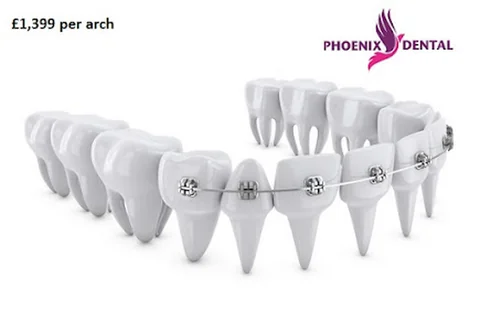 Photo Phoenix Dental Care