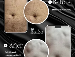 Perfect Piercings, Skin & Laser Clinic