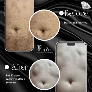 Photo Perfect Piercings, Skin & Laser Clinic