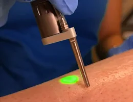 SW Laser Clinic