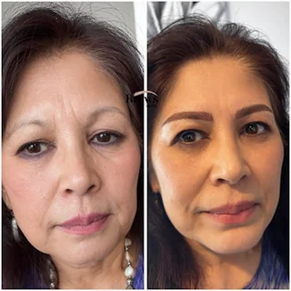 Photo Brows by Rashmi, The Brow Clinic