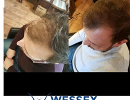 Wessex Trichology Clinic Ltd