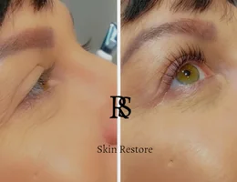 Skin Restore