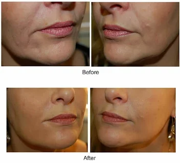 Photo Coltishall Clinic Laser Skin and Vein Care