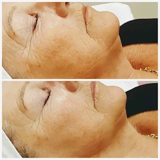 Photo Advanced SKin Therapy/FaceYoga