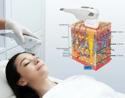 Photo Elysia Skin Body Laser Aesthetics