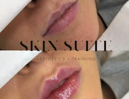 Skin Suite Aesthetics + Training Academy