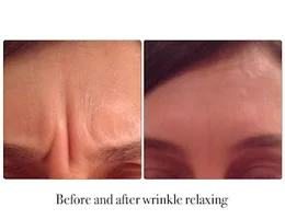 Rejuvenate Facial Aesthetics