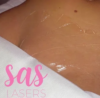 Photo SAS Lasers