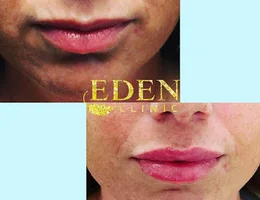 Eden Aesthetics Clinic Plymouth