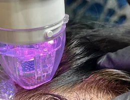 Laser Skin Medical