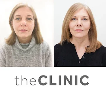 Photo The Clinic Cheshire