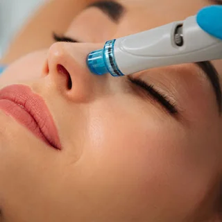 Photo Laser Hair Removal Walsall | Bayside Aesthetics