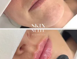 Skin Suite Aesthetics + Training Academy