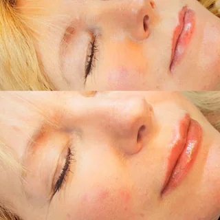 Photo Brighton Permanent Makeup